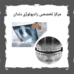 آشنایی با خدمات بهترین مرکز رادیولوژی دندان سعادت آباد