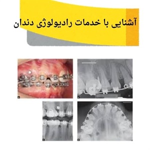رادیولوژی دندان و اهمیت آن در تشخیص دقیق بیماری ها
