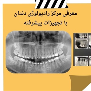 بررسی مهمترین خدمات رادیولوژی دندان سعادت آباد